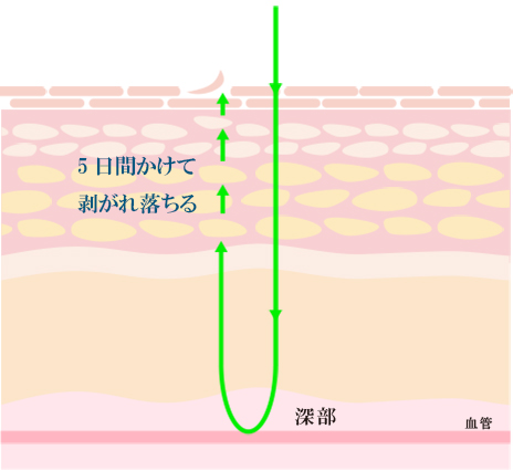 グリーンピールイメージ